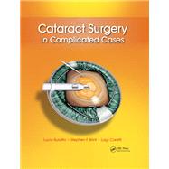 Cataract Surgery in Complicated Cases