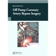 Off-Pump Coronary Artery Bypass Surgery