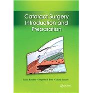 Cataract Surgery
