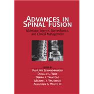 Advances in Spinal Fusion: Molecular Science, Biomechanics, and Clinical Management