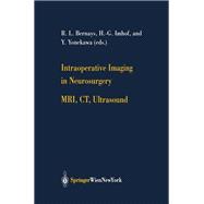 Intraoperative Imaging in Neurosurgery