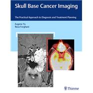 Skull Base Cancer Imaging