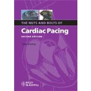 The Nuts And Bolts Of Cardiac Pacing