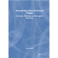 Interpreting Musculoskeletal Images
