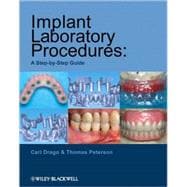 Implant Laboratory Procedures : A Step-by-Step Guide