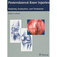 Posterolateral Knee Injuries