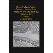 Direct Myocardial Revascularization