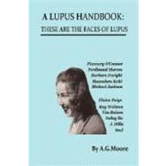A Lupus Handbook