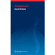 Handbook of Osteoporosis