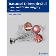 Transnasal Endoscopic Skull Base and Brain Surgery
