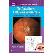 The Optic Nerve Evaluation in Glaucoma An Interactive Workbook