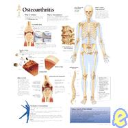 Understanding Osteoarthritis chart Laminated Wall Chart