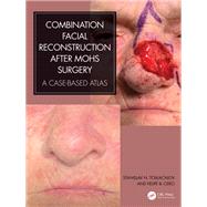 Combination Facial Reconstruction after Mohs Surgery