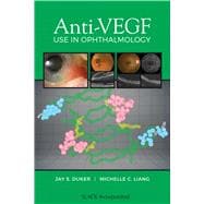 Anti-vegf Use in Ophthalmology