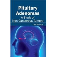 Pituitary Adenomas: A Study of Non Cancerous Tumors