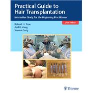 Practical Guide to Hair Transplantation