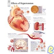 Effects of Hypertension chart Wall Chart