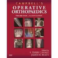 Campbell's Operative Orthopaedics