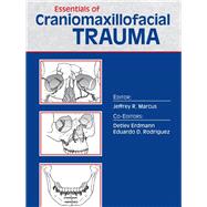 Essentials of Craniomaxillofacial Trauma