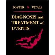 Diagnosis and Treatment of Uveitis