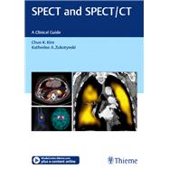 SPECT and SPECT/CT