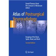 Atlas of Postsurgical Neuroradiology