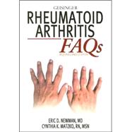 Rheumatoid Arthritis Faqs