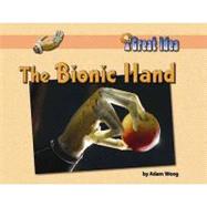 Bionic Hand, the
