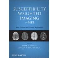 Susceptibility Weighted Imaging in MRI : Basic Concepts and Clinical Applications