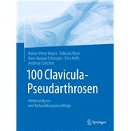 100 Clavicula-pseudarthrosen