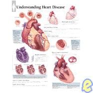 Understanding Heart Disease chart Wall Chart