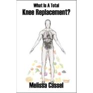 What Is a Total Knee Replacement?