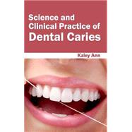 Science and Clinical Practice of Dental Caries