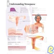 Understanding Menopause chart Laminated Wall Chart
