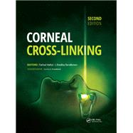 Corneal Cross-Linking
