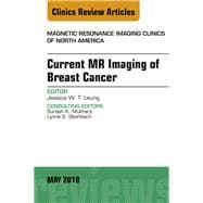 Current Mr Imaging of Breast Cancer