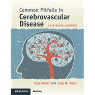 Common Pitfalls in Cerebrovascular Disease: Case-Based Learning