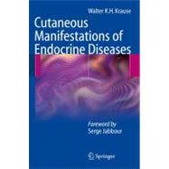 Cutaneous Manifestations of Endocrine Diseases