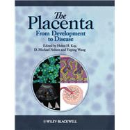 The Placenta From Development to Disease