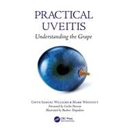 Practical Uveitis