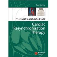 The Nuts and Bolts of Cardiac Resynchronization Therapy