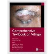 Comprehensive Textbook on Vitiligo