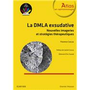Stratégies Thérapeutiques Dans La Dmla Exsudative