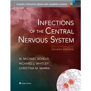 Infections of the Central Nervous System
