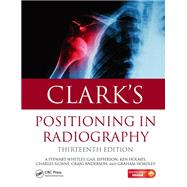 Clark's Positioning in Radiography