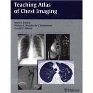 Teaching Atlas of Chest Imaging
