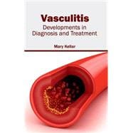 Vasculitis: Developments in Diagnosis and Treatment