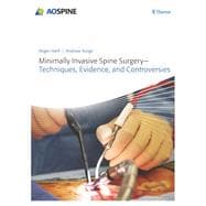 Minimally Invasive Spine Surgery: Techniques, Evidence, and Controversies