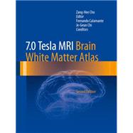 7.0 Tesla MRI Brain White Matter Atlas