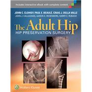 The Adult Hip Hip Preservation Surgery